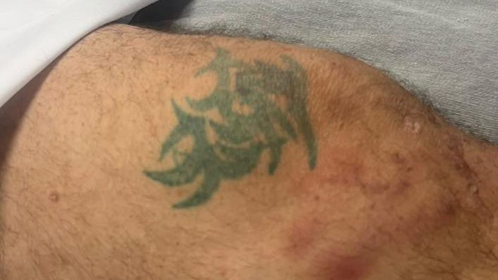 Cobertura informativa sobre huop pede ajuda para identificar homem internado na uti após queda de altura em cascavel em Toledo